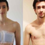 Understanding Female to Male Transition Photos, Experiences, and Insights